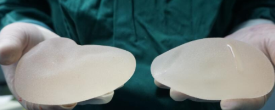 假體豐胸手術(shù)與其他豐胸方法相比有何優(yōu)勢？